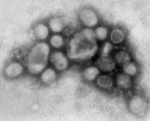 virus-de-gripe-A-H1N1