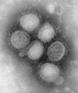 virus-gripe-a-2